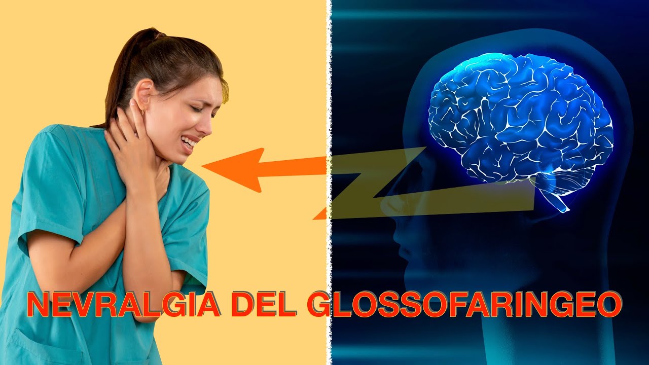 Nevralgia del glossofaringeo