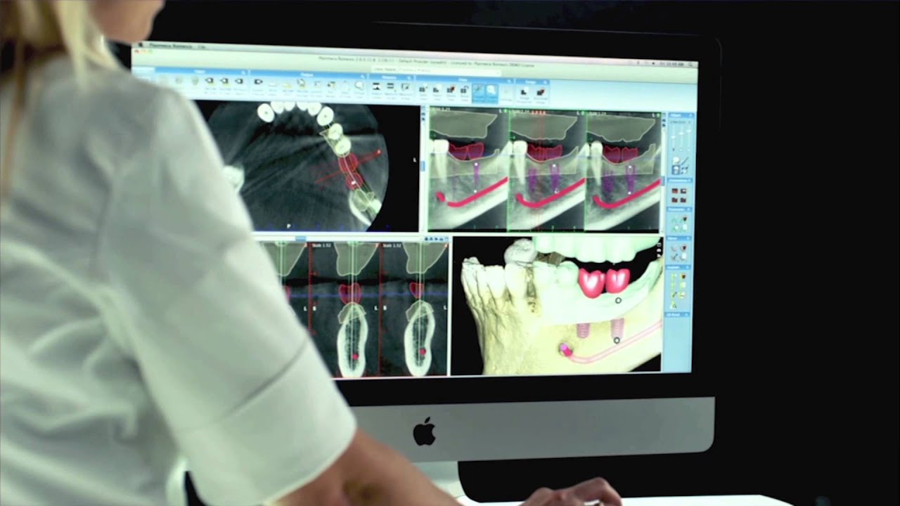 ProMax 3D ProFace