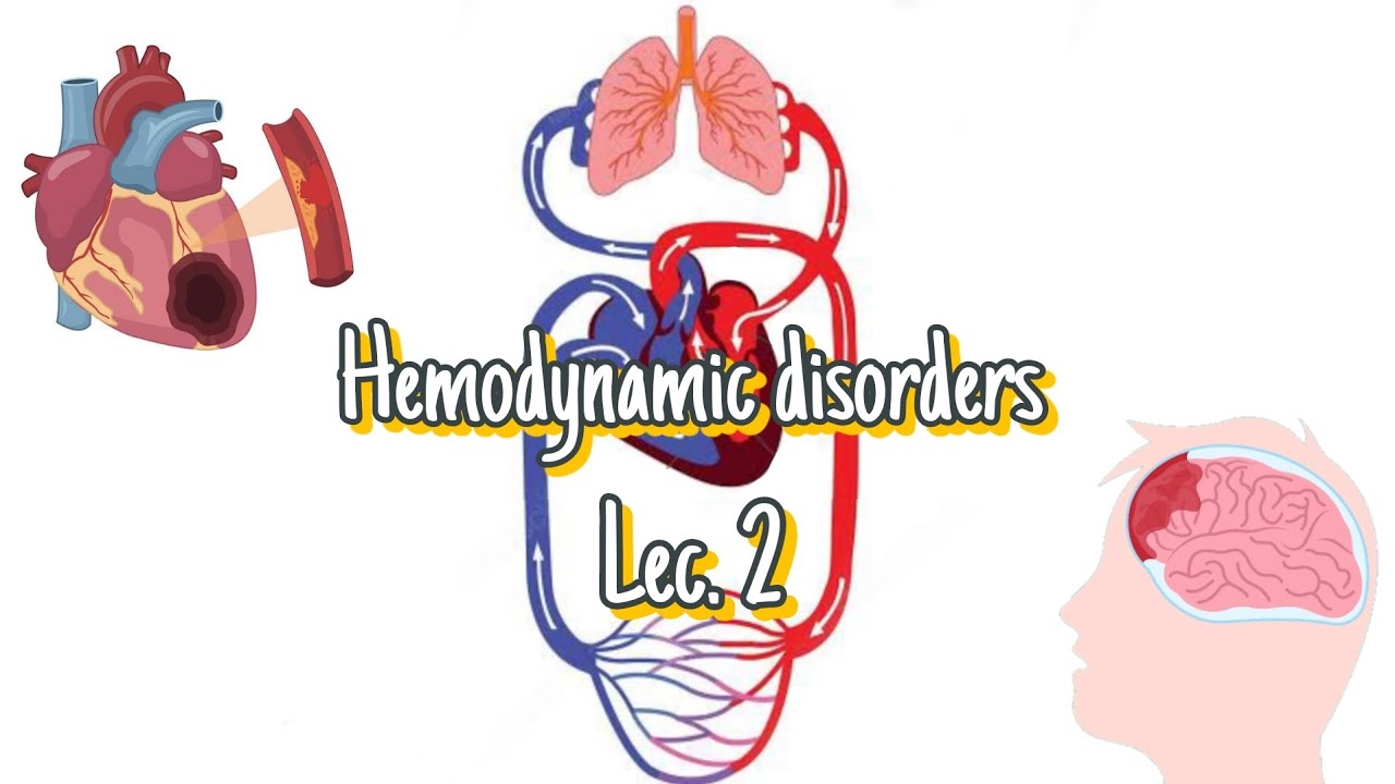 Hemodynamic disorders-Lecture 2(thrombosis-embolism-ischemia&infarction)