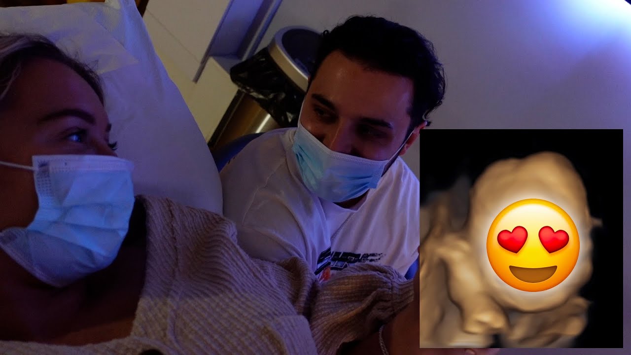 OUR FIRST 4D SCAN! WHO DOES OUR BABY LOOK LIKE?! | Vlog | Pregnancy Week 26