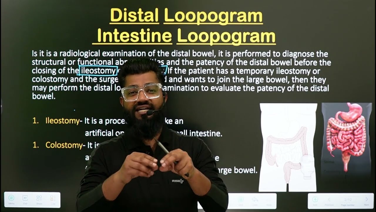 Loopogram Procedure || Distal Loopogram || Part-1 || In Hindi || intestinal Loopogram ||