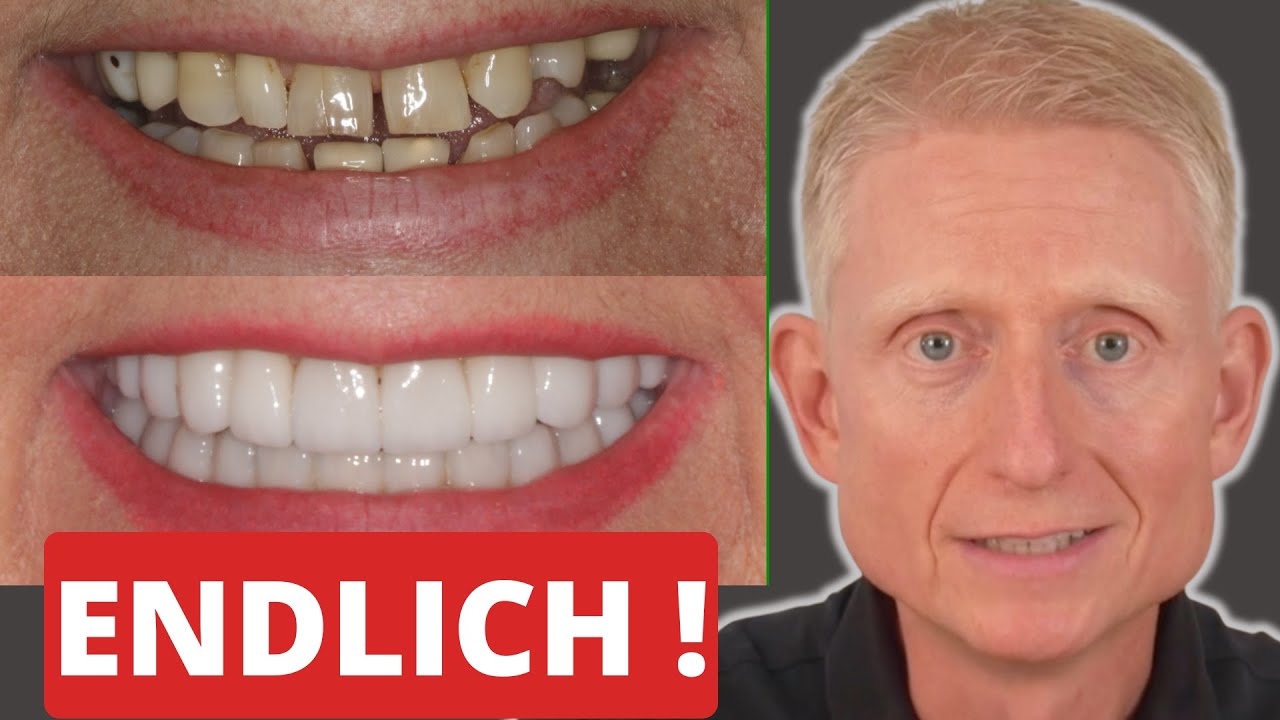 Sie wusste nicht, wie ihr Lächeln aussehen sollte – jetzt strahlt sie!