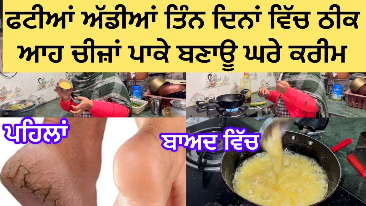 ਕਿ ਤੁਸੀਂ ਵੀ ਫਟੀਆਂ ਅੱਡੀਆਂ ਤੋ ਪਰੇਸ਼ਾਨ ਹੋ ਘਰੇ ਬਣਾਓ ਆਹ ਕਰੀਮ#99.9% safe remedy for craked heels.