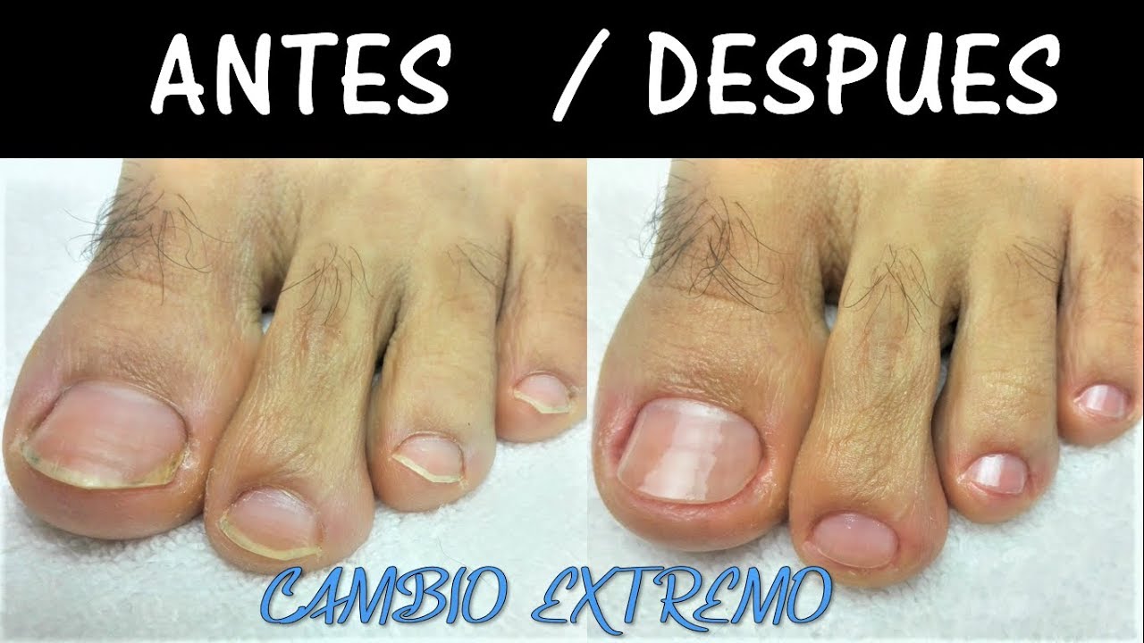 CÓMO HACER UN PEDICURE PASO A PASO MUY FÁCIL - Como hacer un Pedicure paso a paso