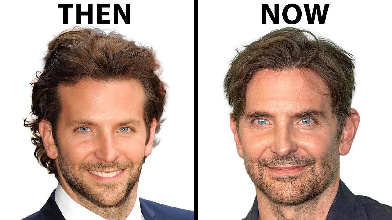 Plastic Surgeon Reacts To Bradley Cooper's NEW FACE