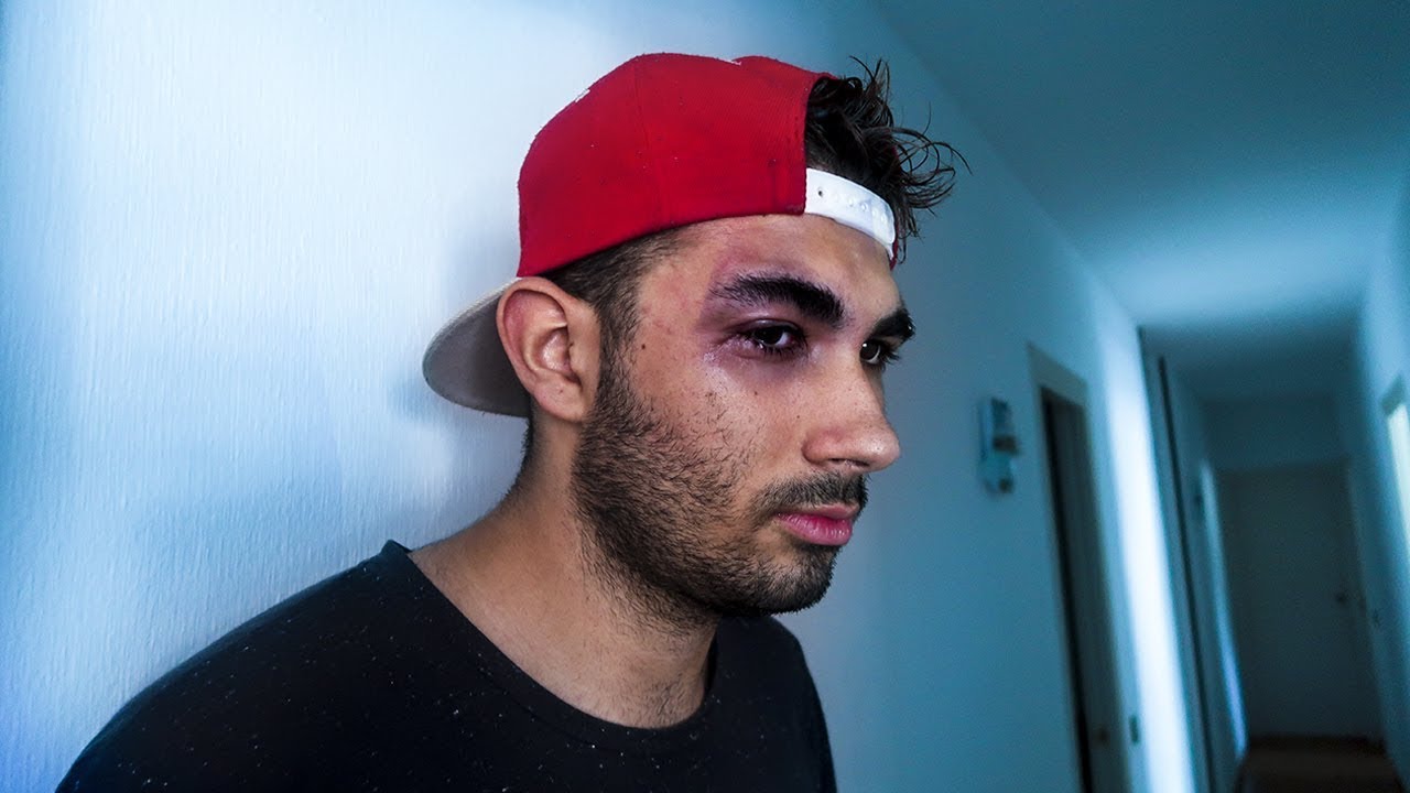 CASI PIERDE UN OJO GRABANDO ESTE VÍDEO *no creerás lo que pasó*