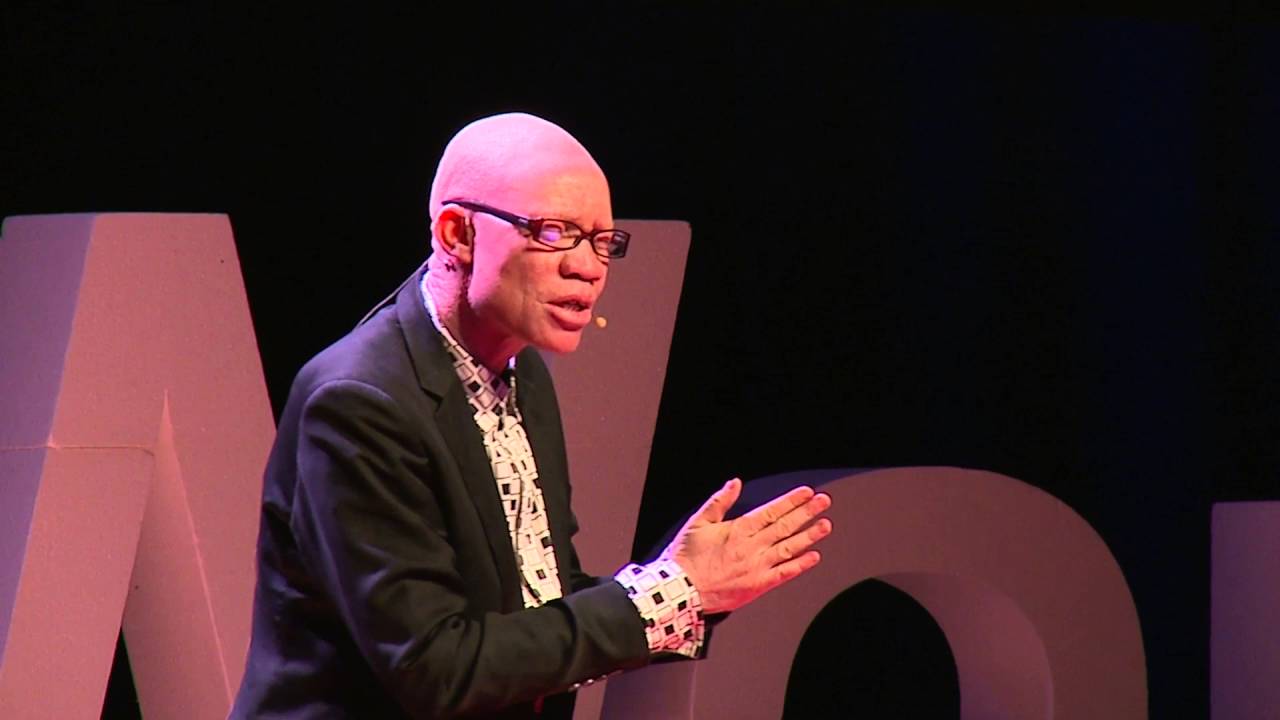 Embracing your Uniqueness | Josephat Torner | TEDxWarwick