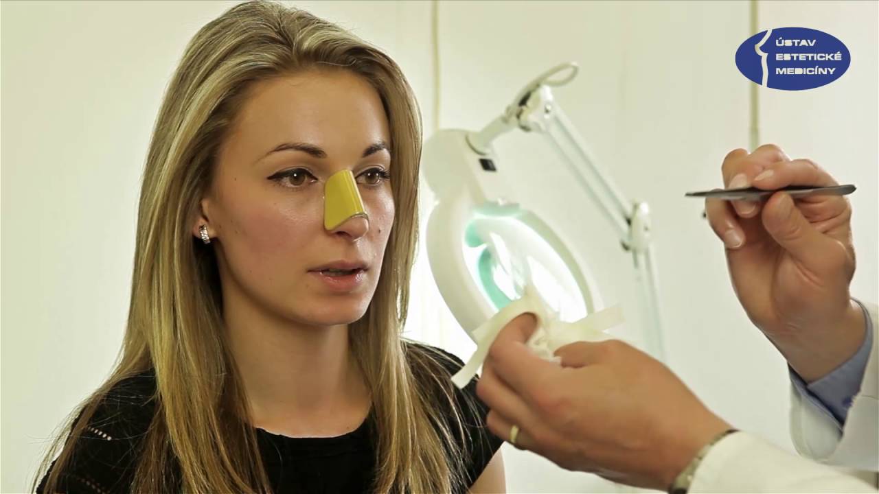 Odstranění tamponády nosu po rhinoplastice – MUDr. Záruba, Ústav estetické medicíny