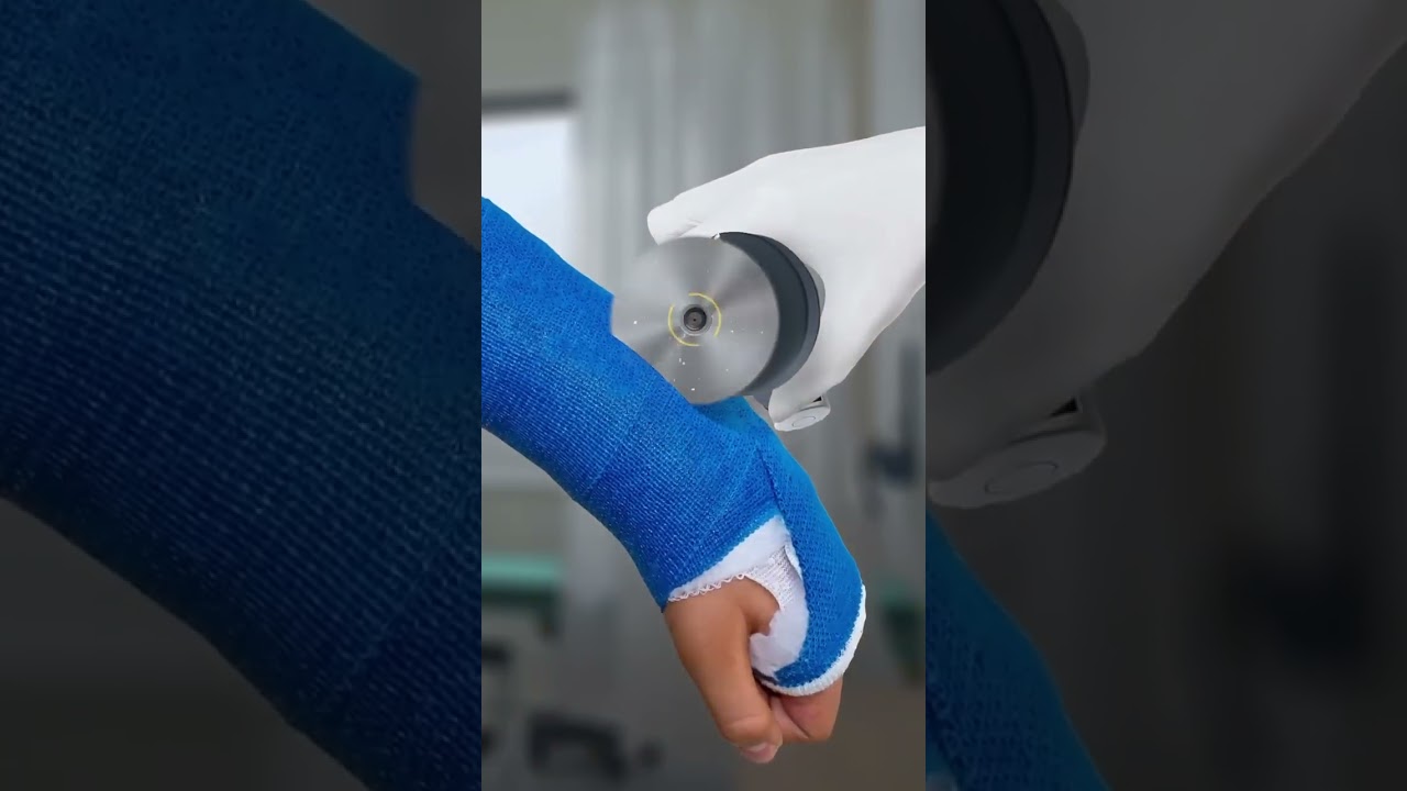 🔍 &iquest;C&Oacute;MO CORTAN LOS YESOS SIN LASTIMAR LA PIEL? (El truco m&eacute;dico que NO sab&iacute;as) 🏥✂️