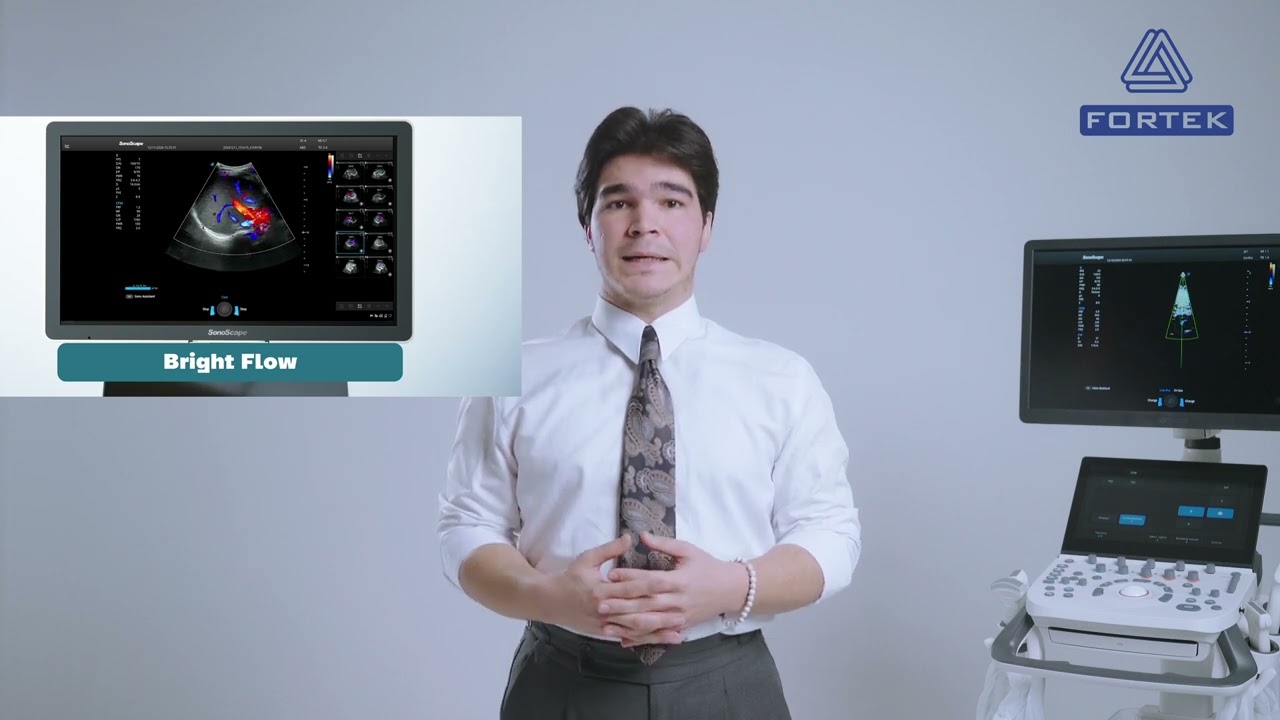Sonoscape P20 Elite: Технология, на которую можно полагаться!