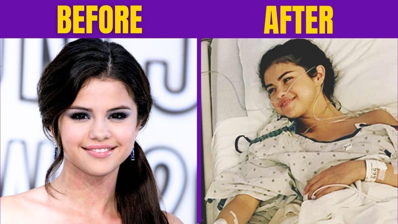 45+ FAMOUS PEOPLE FACING INCURABLE DISEASES