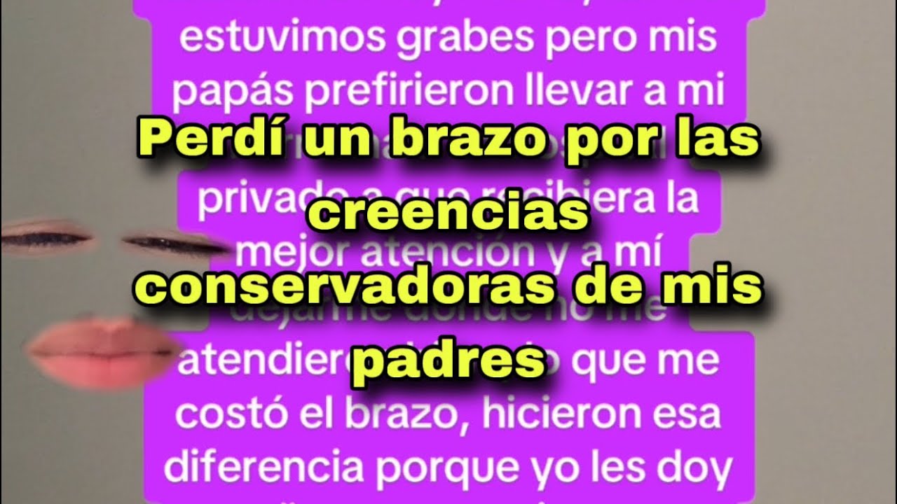 Mi orientación hizo que perdiera un brazo