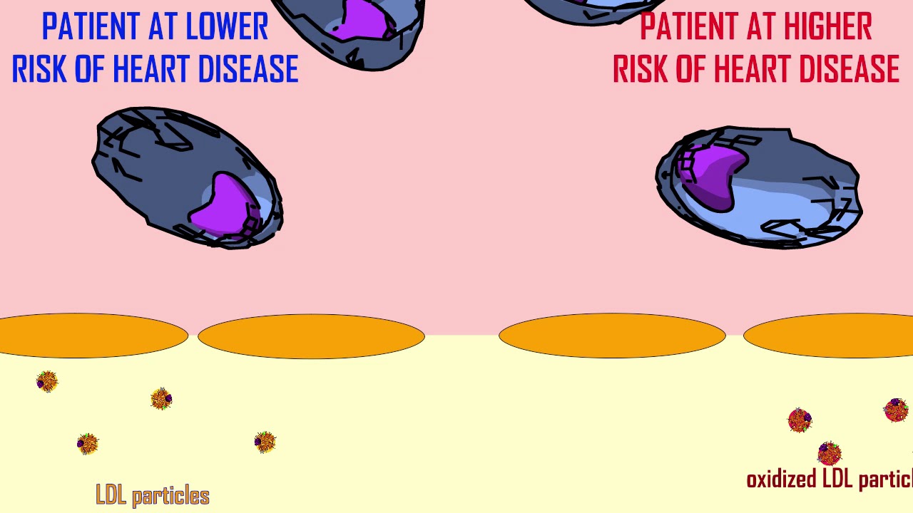 LDL & oxidized LDL PARTICLES IN HEART DISEASE
