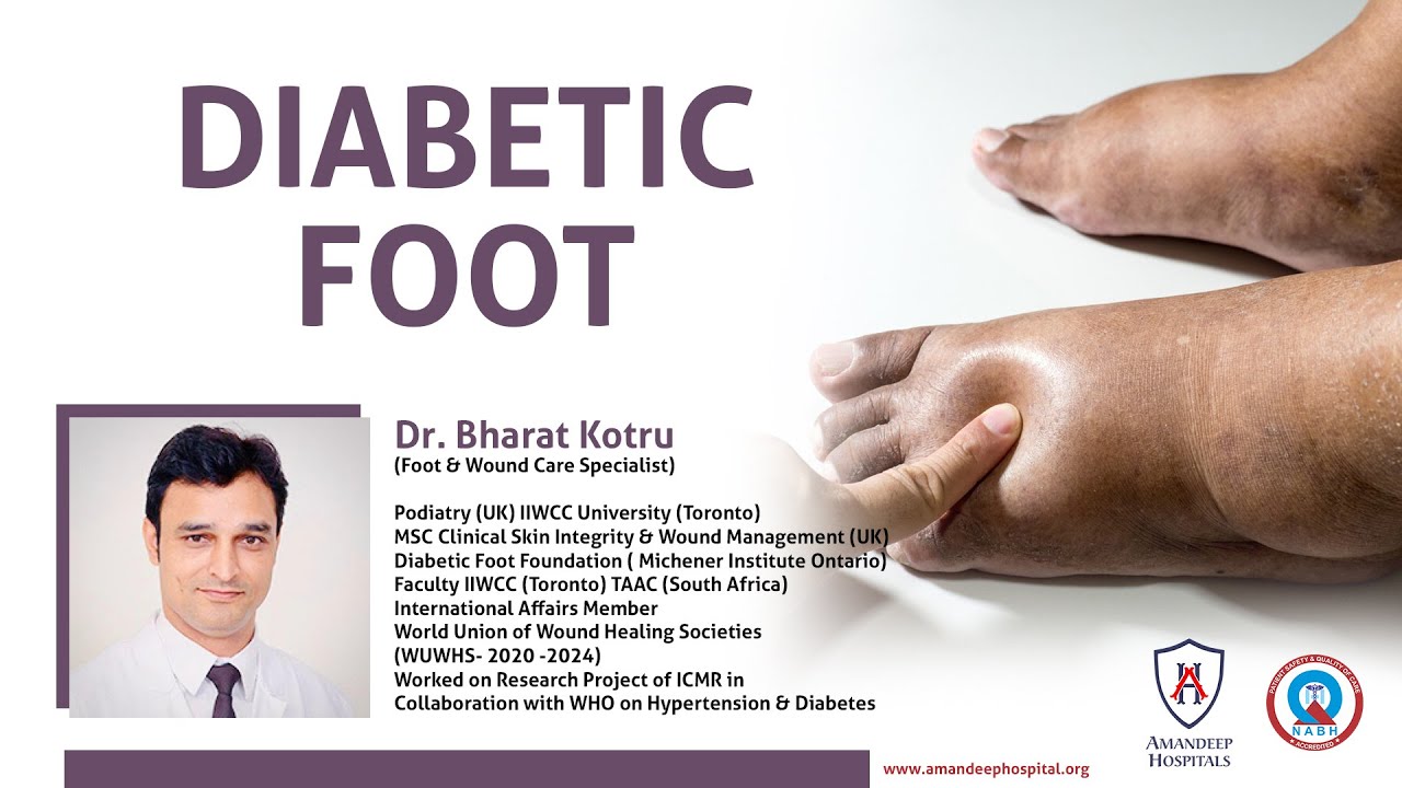 Diabetic Foot: Diagnosis, Treatment & Care | Dr. Bharat Kotru | Foot & Wound Care Specialist