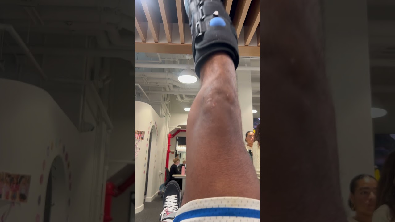 #thegetback #therapy #foot