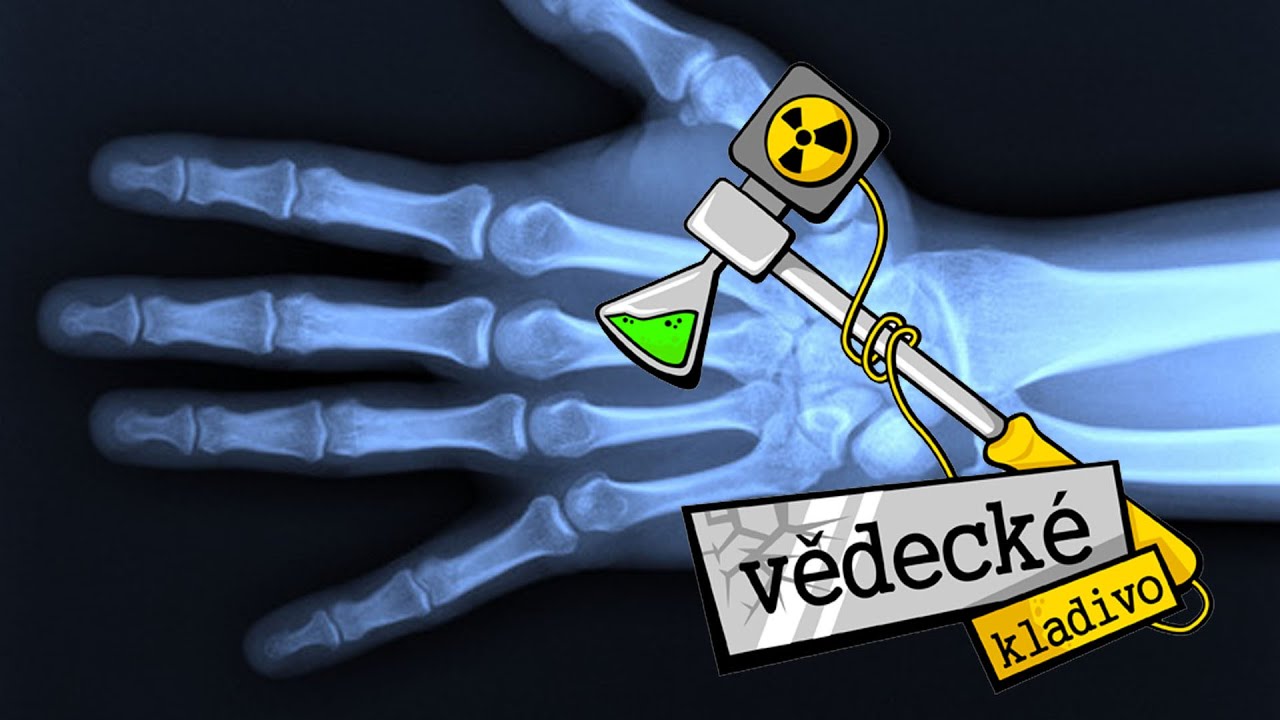 Jak funguje rentgen? - Vědecké kladivo