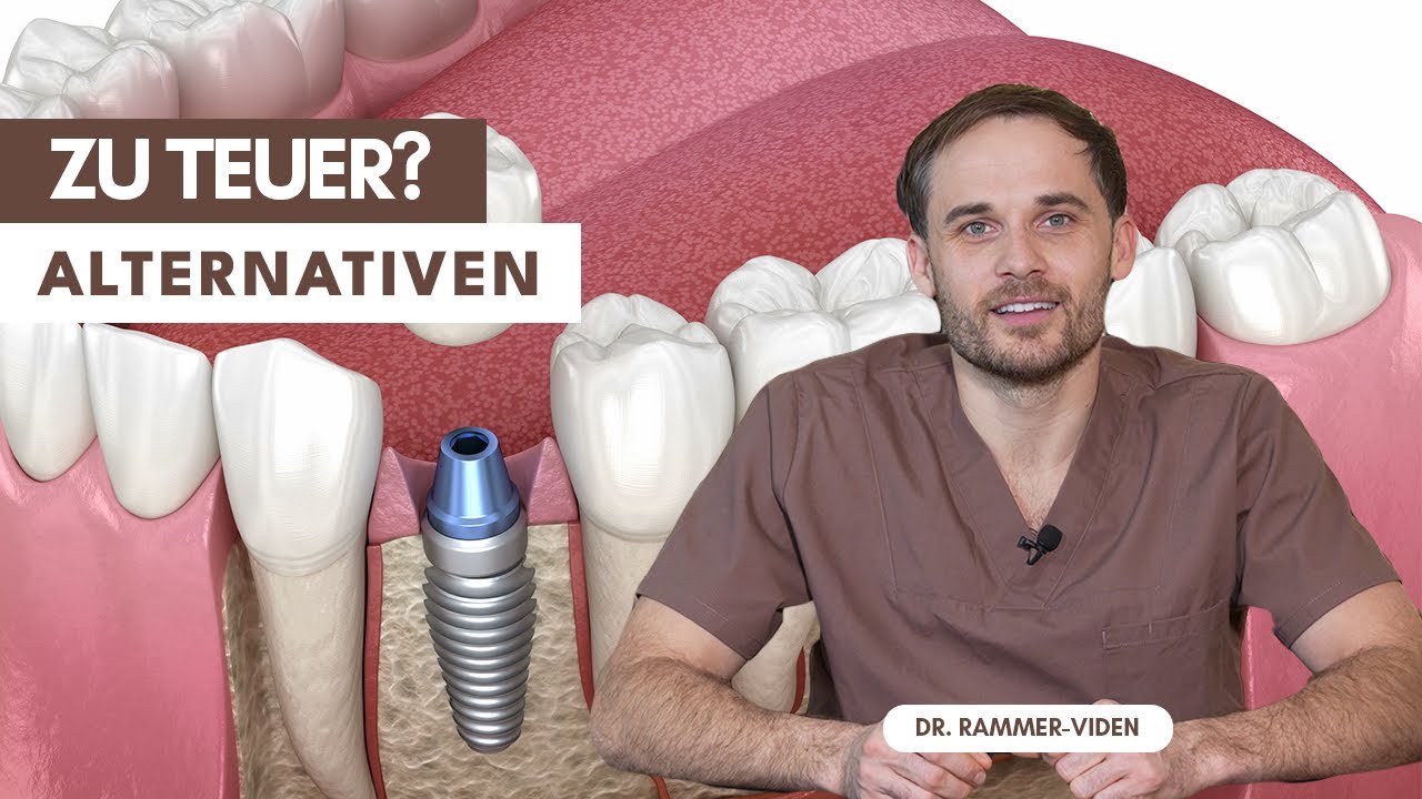 Zahnimplantat zu teuer? Diese Alternativen solltest du kennen