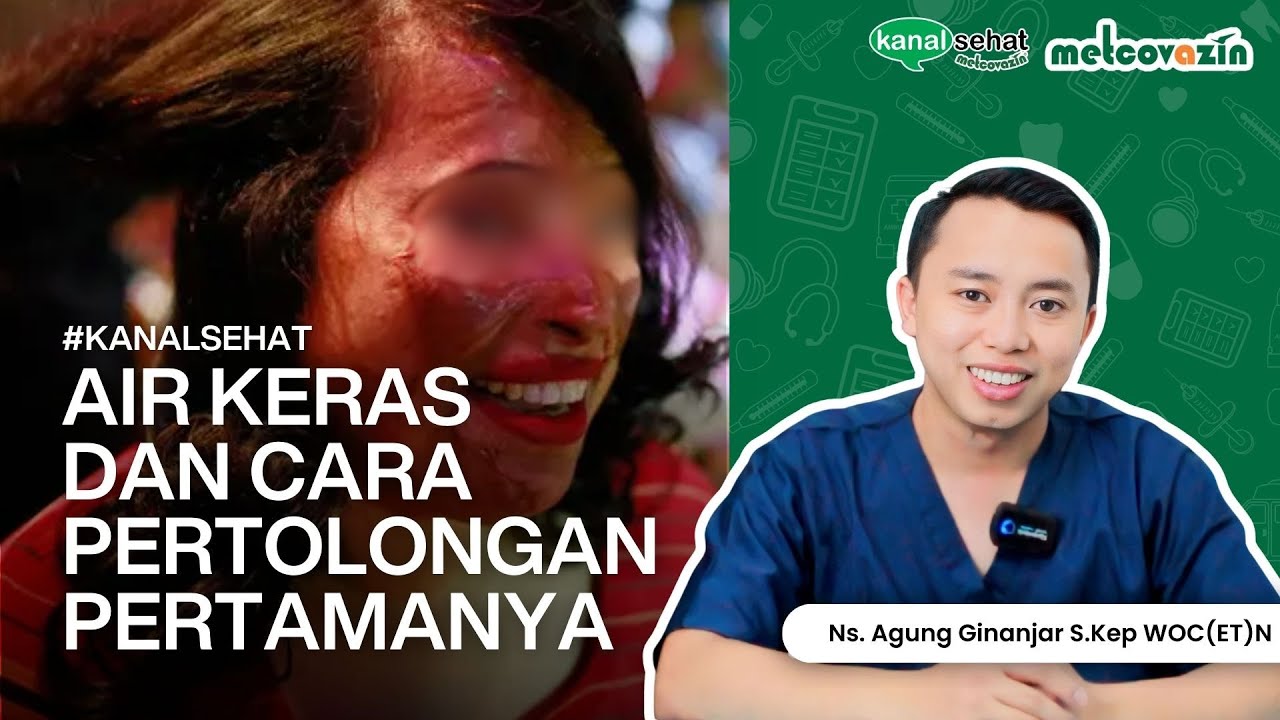 PERTOLONGAN PERTAMA JIKA TERKENA AIR KERAS! SEPERTI AGUS SEDIH | Kanal Sehat by Metcovazin