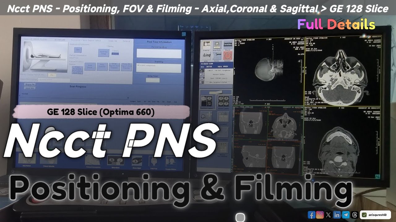 Ncct PNS  | Positioning & Filming | GE 128 Slice ( Optima660) | By Anis Qureshi