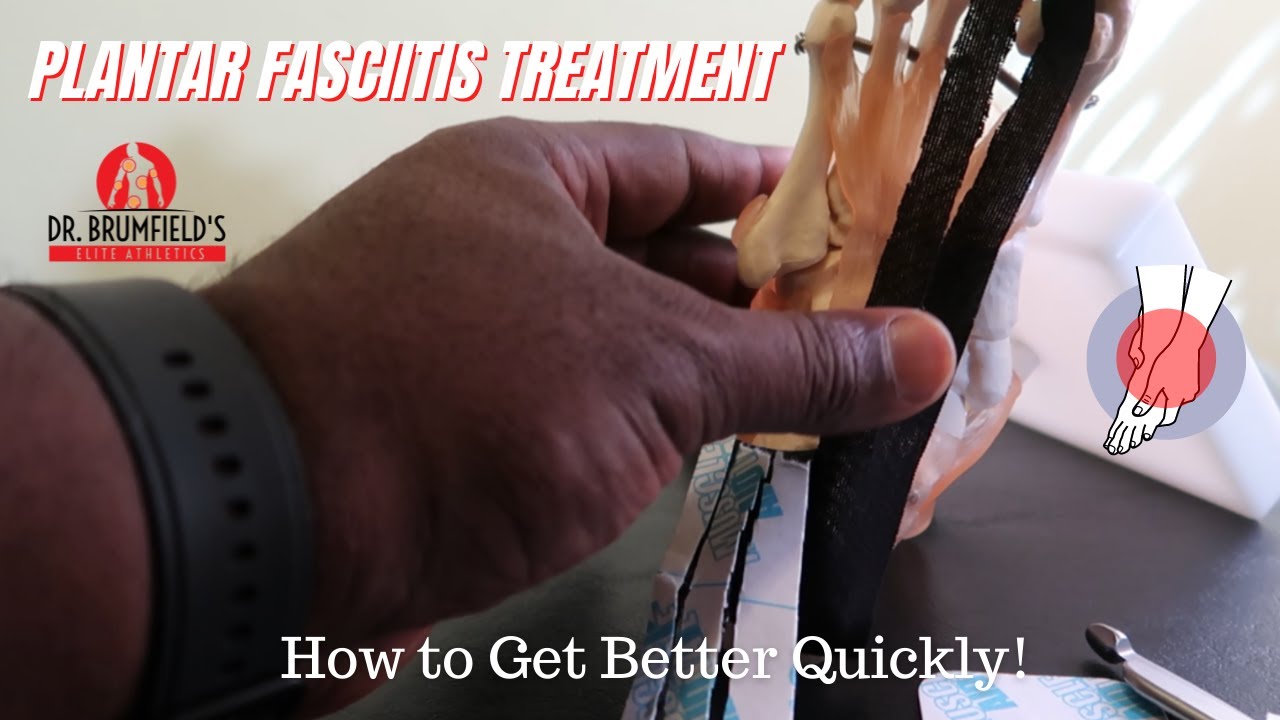 Plantar Fasciitis Treatment - How to Get Better Quickly