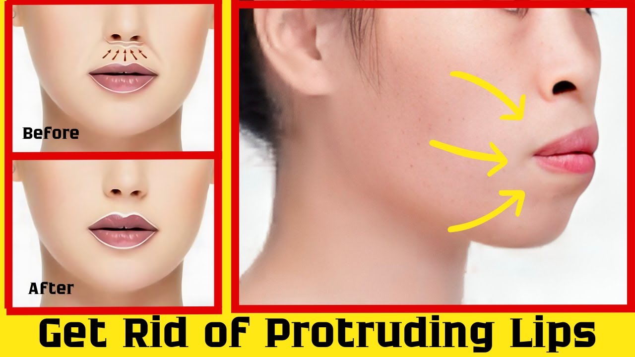 Get Rid of Protruding Mouth and Lips with These Simple Exercises!