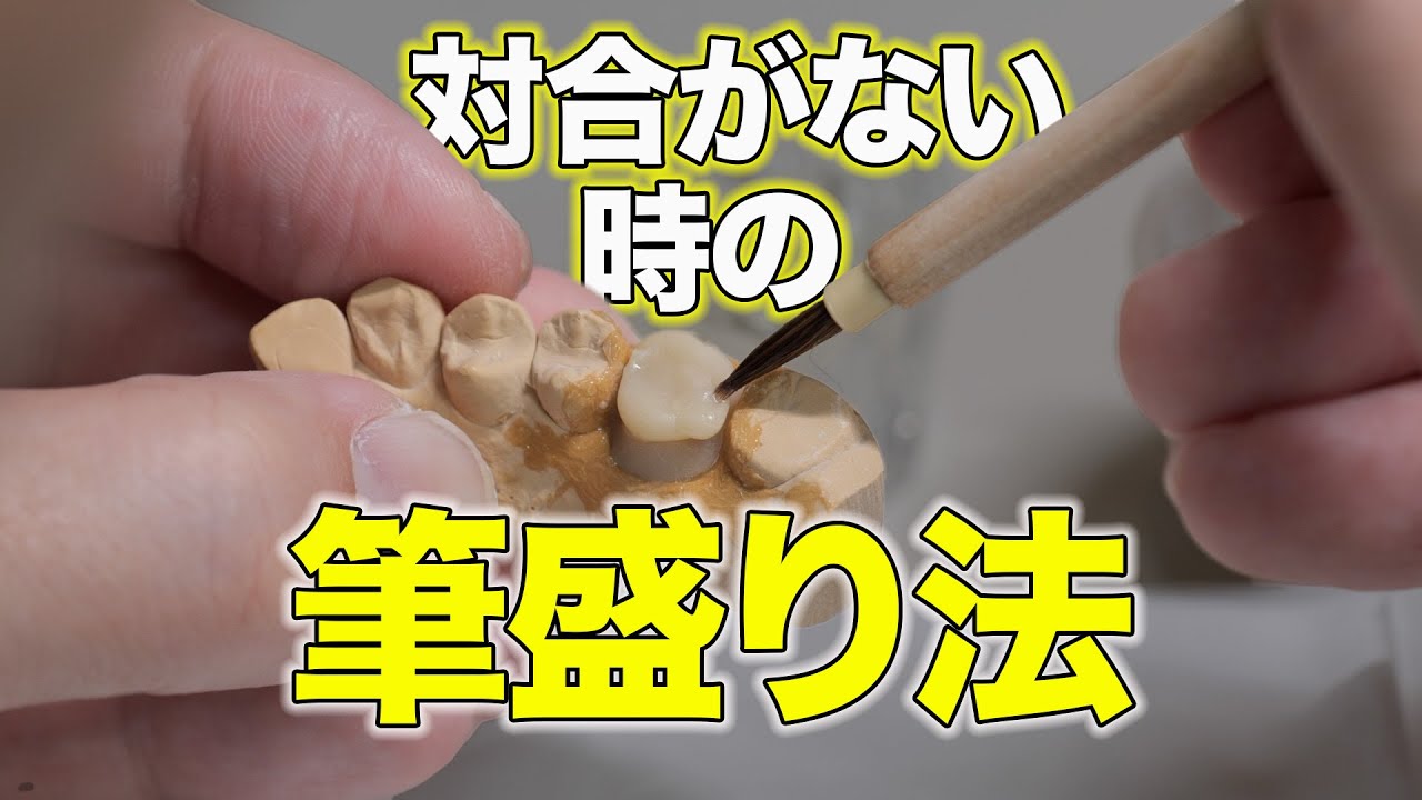 【仮歯の作り方】対合が無い時の筆盛り法