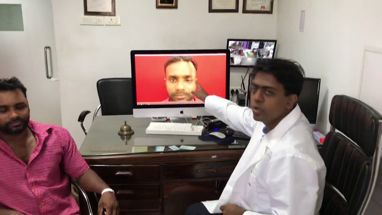 Forehead and Orbit Reconstruction by Dr Sunil Richardson - Craniofacial Surgery