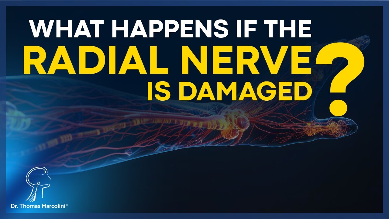 Radial Nerve Injury? Warning Signs, Causes & the Best Treatments You Need to Know!