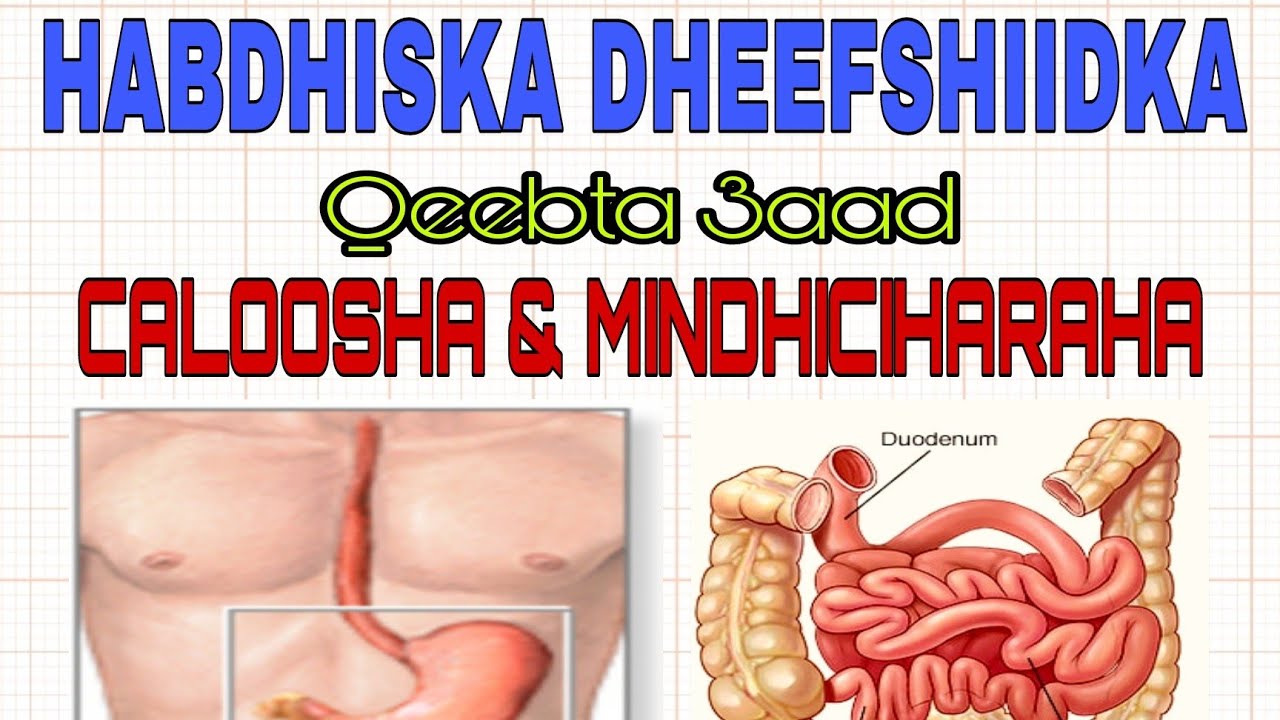 HABDHISKA DHEEFSHIIDKA(3)
