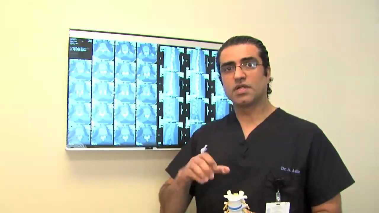 Spondylolisthesis - Spine Conditions