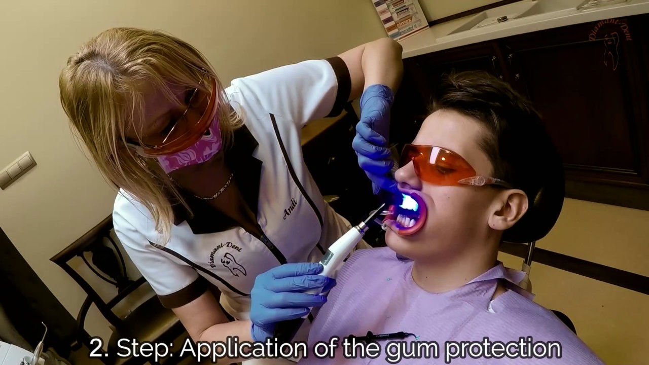 Bleaching with Biolase Laser, snow-white teeth in 20 minutes! Dental Clinic Hungary, Diamant-Dent
