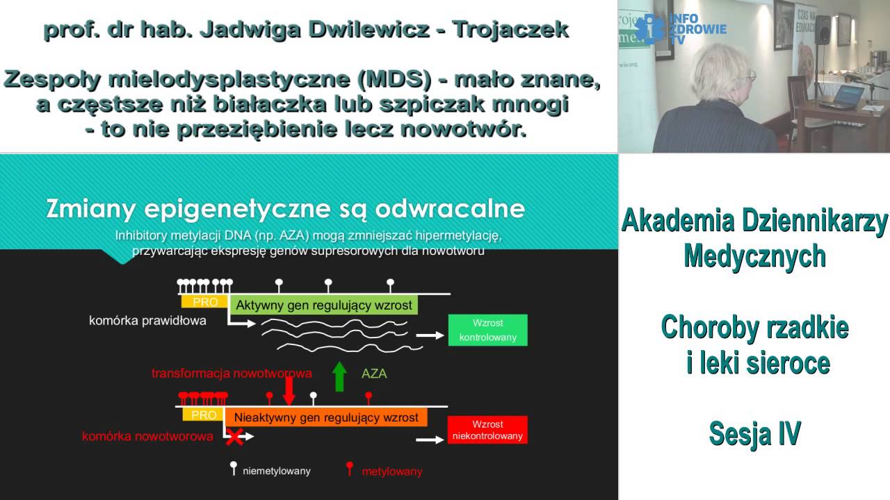Zespoły mielodysplastyczne (MDS) -- mało znane, a częstsze niż białaczka
