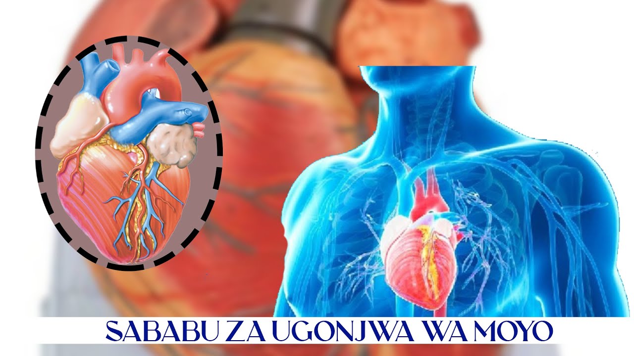 PROF. JANABI : WATU MIL.18 VIFO VYAO VINASABABISHWA NA UNGONJWA WA MOYO SABABU HIZI HAPA