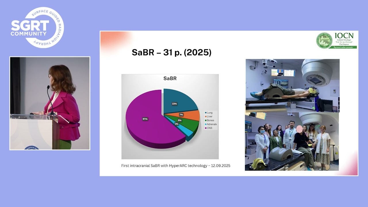 Enhancing Radiation Therapy Precision and Workflow with Vision RT Surface Guided Radiation Therapy
