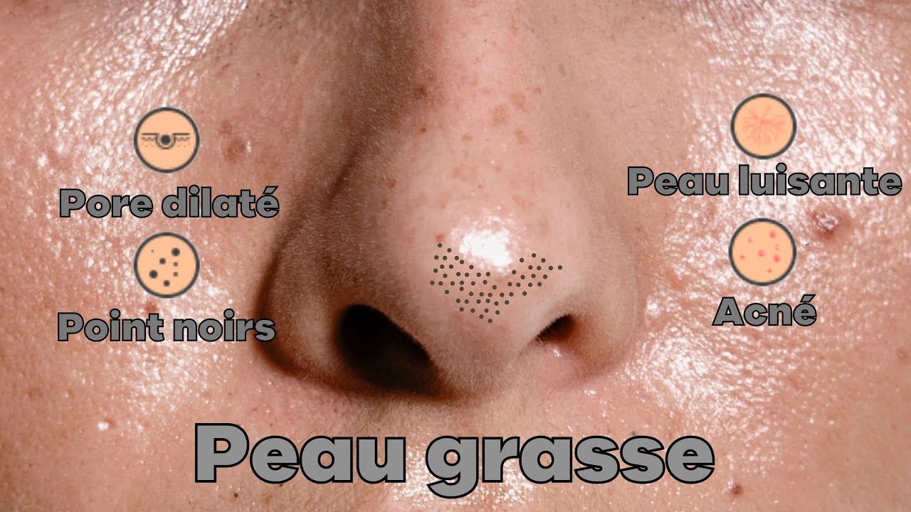 COMMENT AVOIR LA PEAU MOINS GRASSE ?