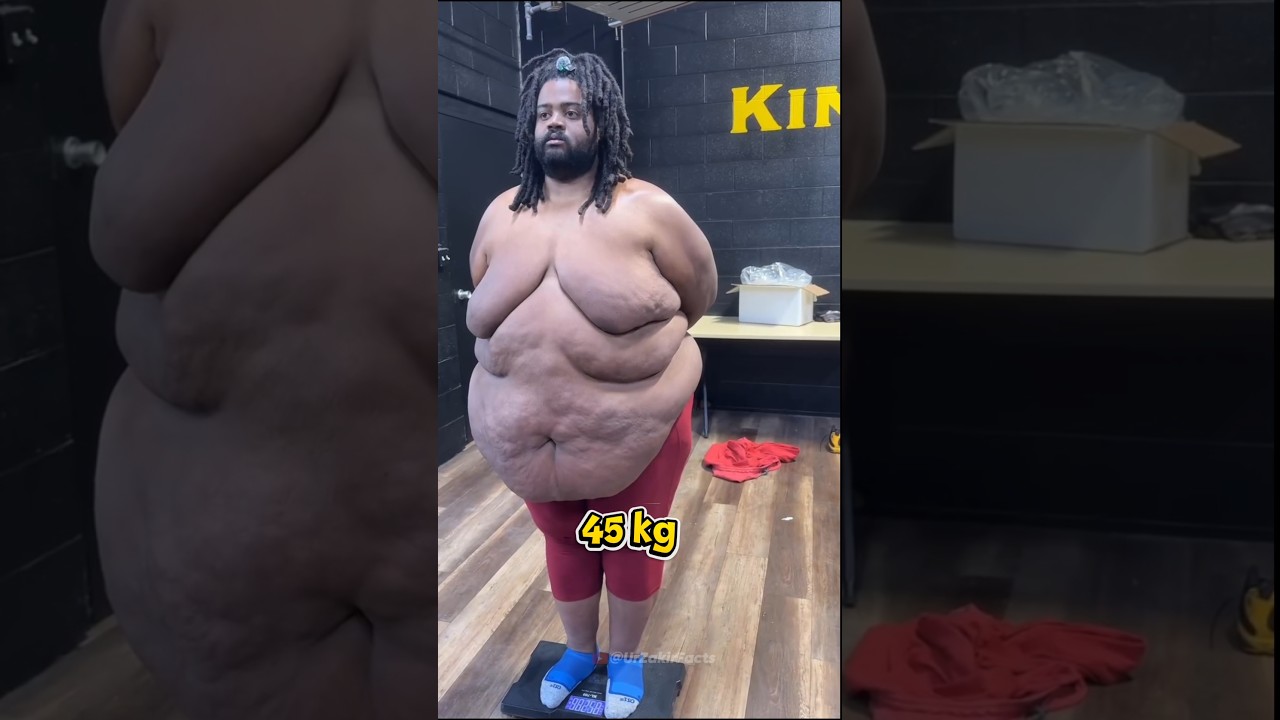 328 KG 😱 Shocking Story #facts #shorts