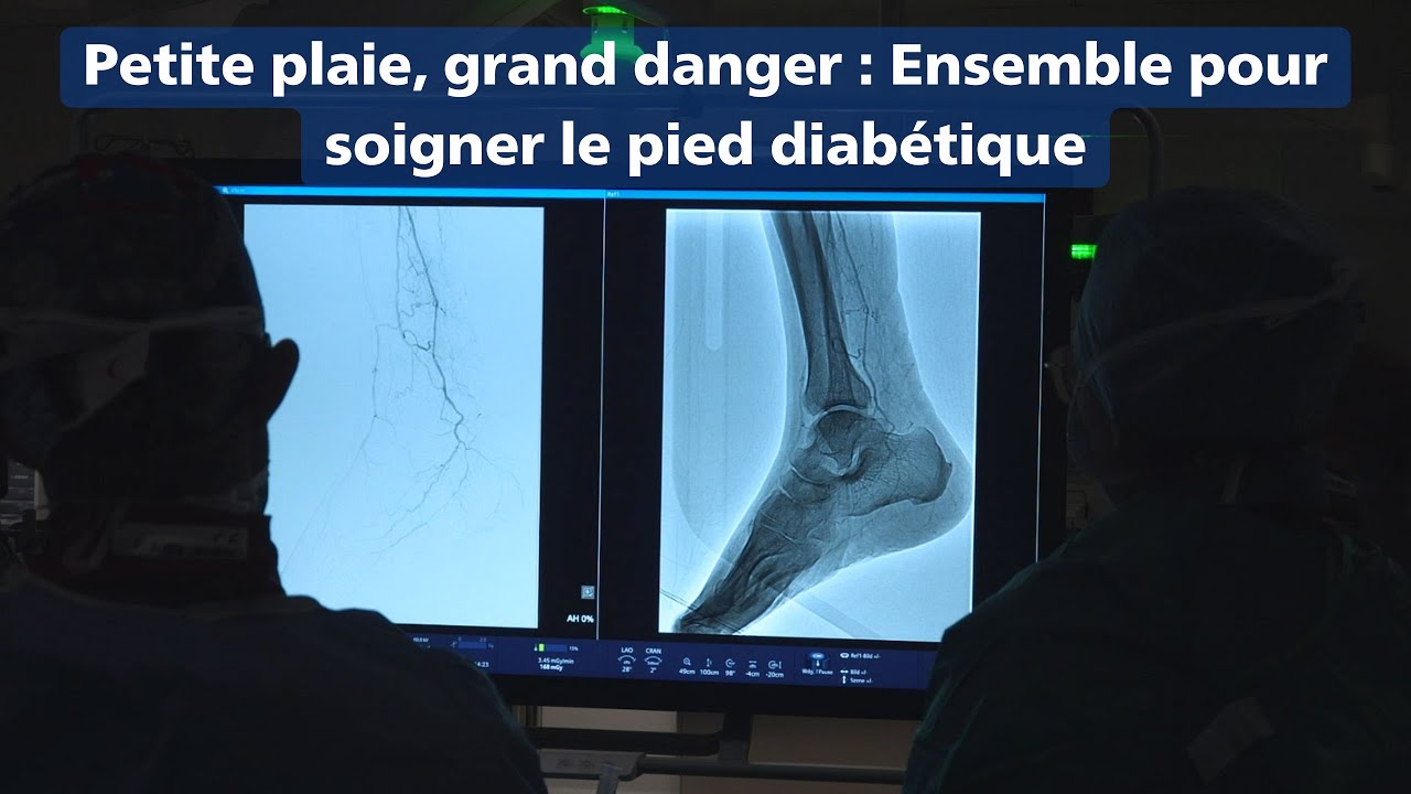 Petite plaie, grand danger : Ensemble pour soigner le pied diabétique