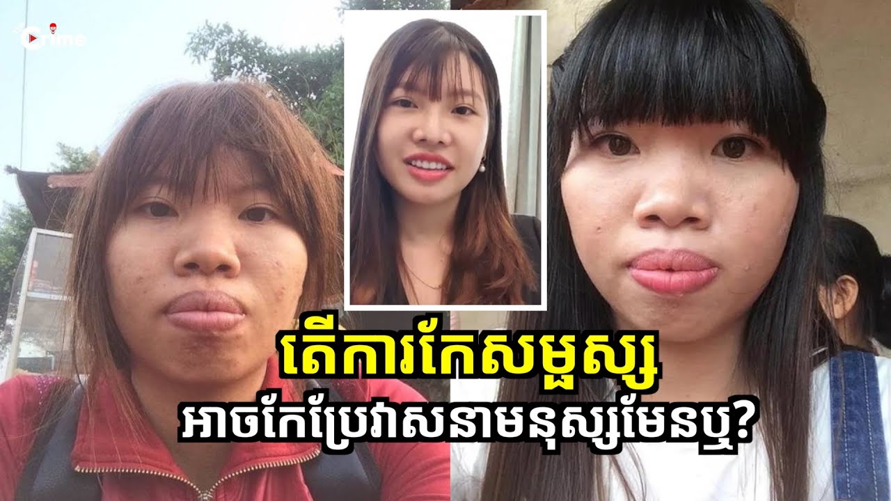 តើការកែសម្ផស្សរបស់គីមហ្វឿងអាចកែប្រែជោគវាសនារបស់នាងបានឬ?