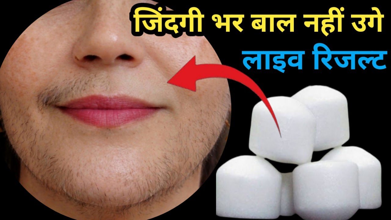 डॉक्टर ने बताया👉फिटकरी से बिना किसी दर्द चेहरे के बाल निकलने का आसन तरीका😱प्रूफ देखो || facial hair