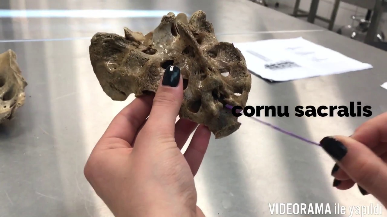 Torakal ve Lumbal Vertebra/Os Sacrum