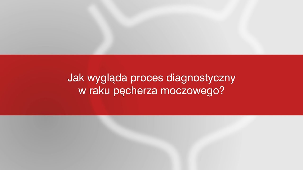 Iwona Skoneczna | 