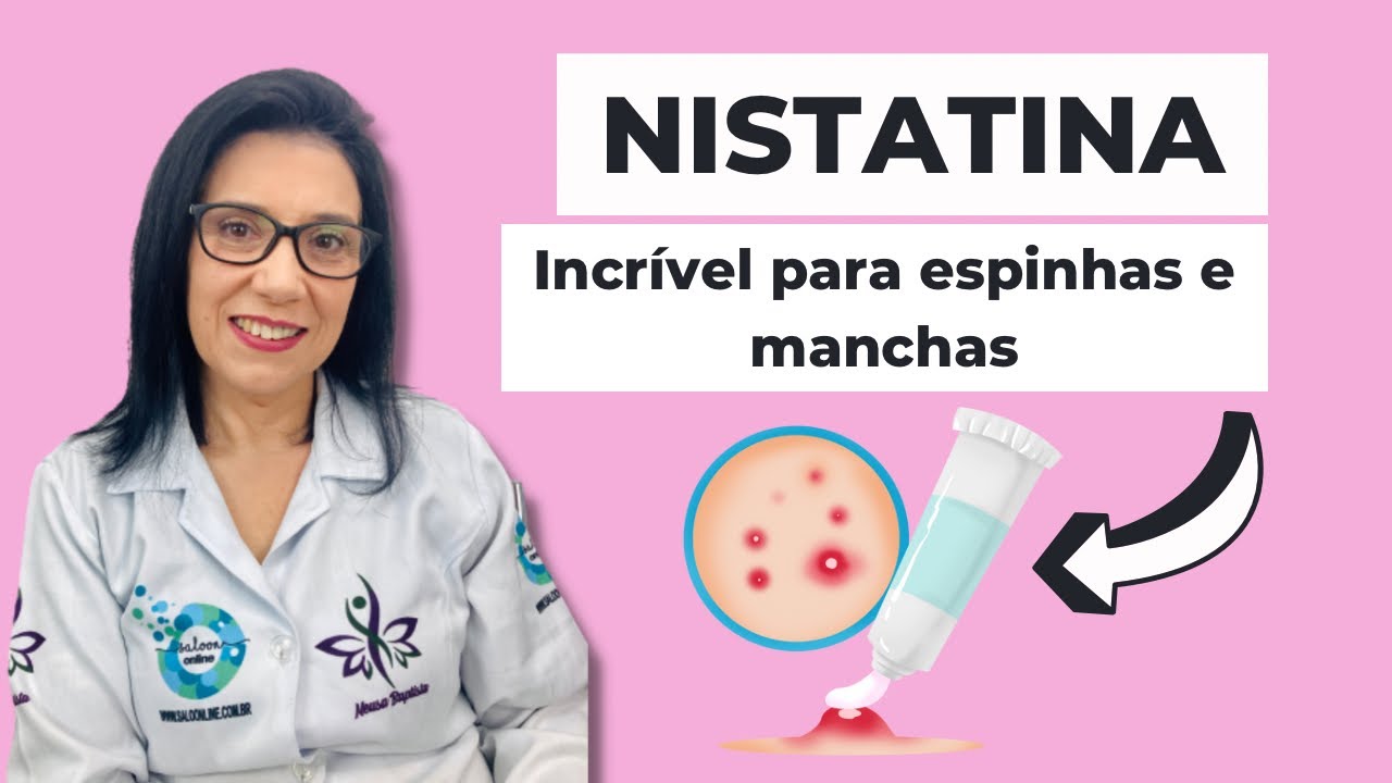 NISTATINA POMADA INCRÍVEL PARA PELE!MANCHAS, ESPINHAS E MUITO MAIS!
