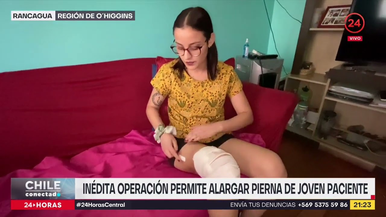 Inédita operación permite alargar pierna de joven paciente | 24 Horas TVN Chile