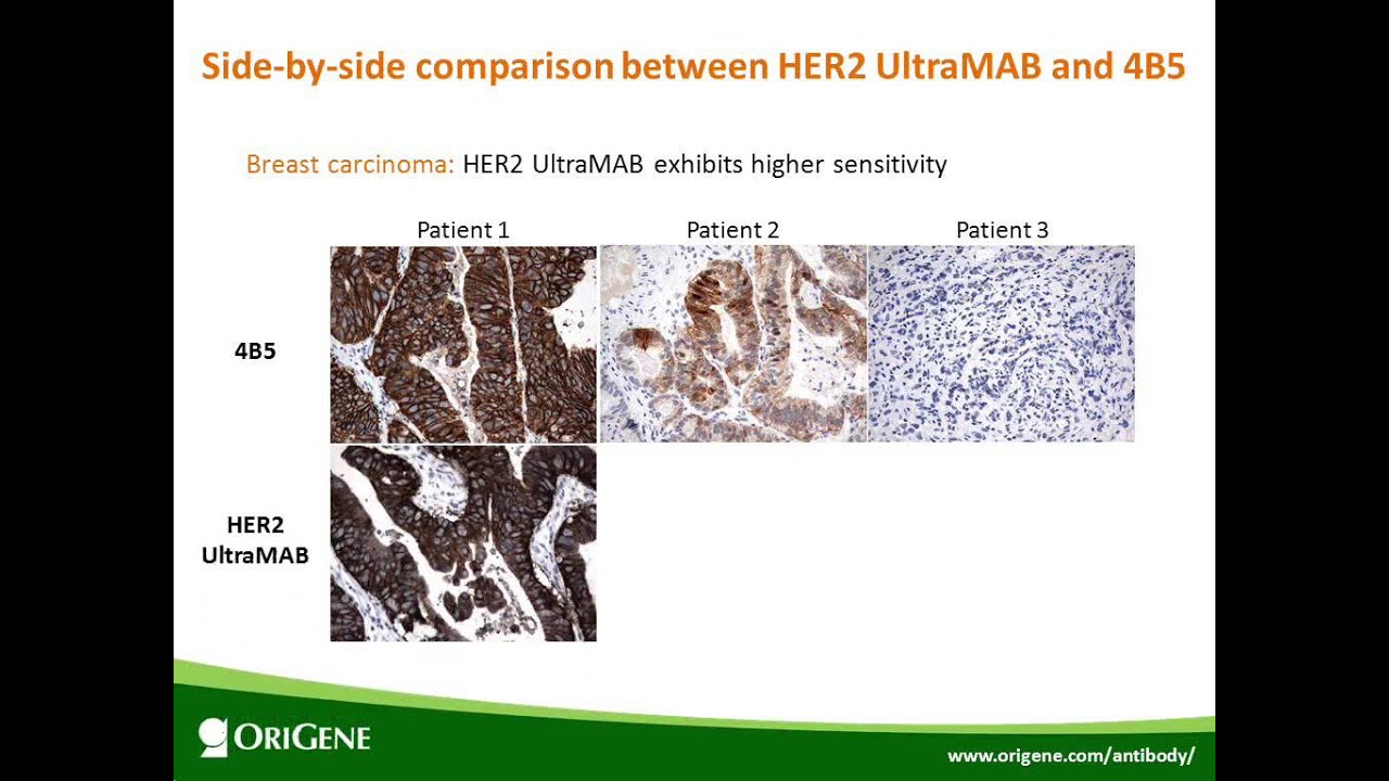 Webinar: New Tool for Antibody Specificity Testing