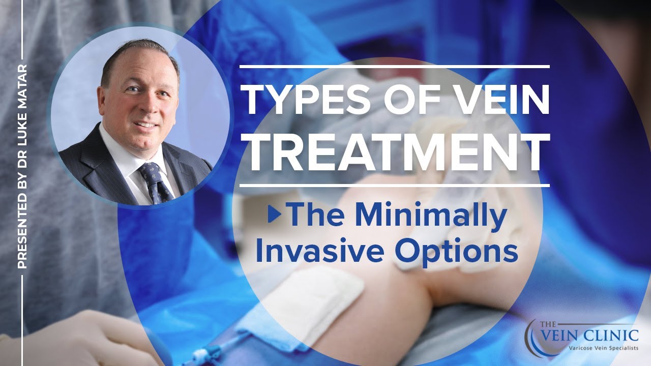 Types of Vein Treatment: The Minimally Invasive Options - THE VEIN CLINIC PERTH - VEIN TREATMENT FAQ