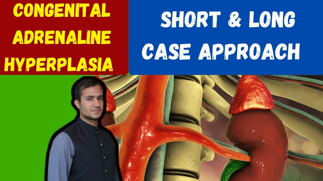 Congenital adrenal hyperplasia (CAH) and Ambiguous Genitalia | Practical Approach & Case Discussion