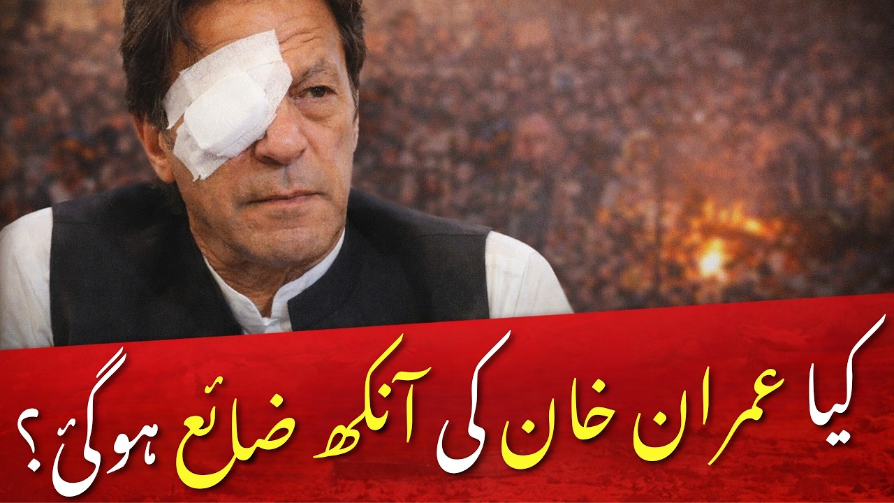 What is wrong with Imran khans Eye. What is CENTRAL RETINAL VEIN OCCLUSION 