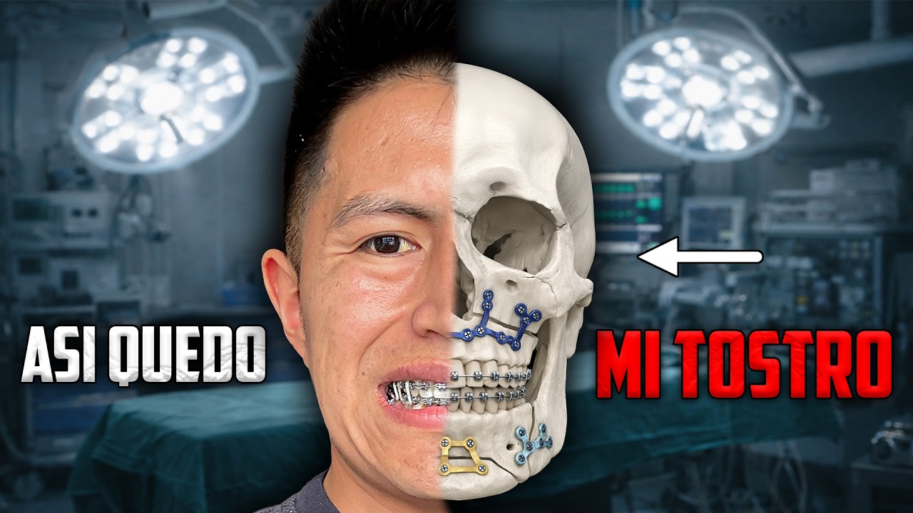 MI ROSTRO QUEDO ASI - Ni Q' Fuera TV, Karito La Tóxica