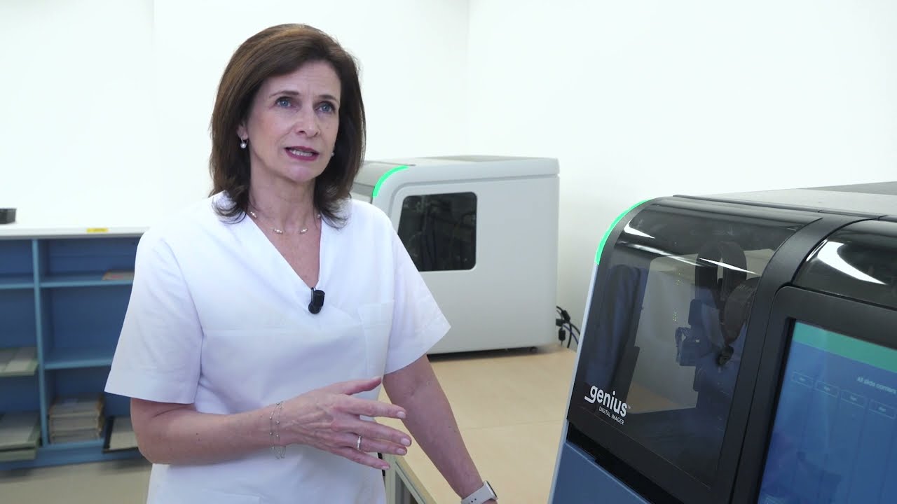 AI pomáhá v Bioptické laboratoři hodnotit vyšetření v rámci screeningu karcinomu děložního hrdla