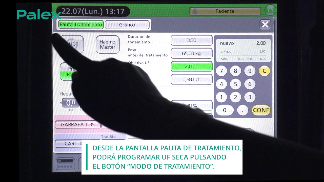 4  Programaci&oacute;n pauta y UF seca  TUTORIAL Nikkiso DBB EXA